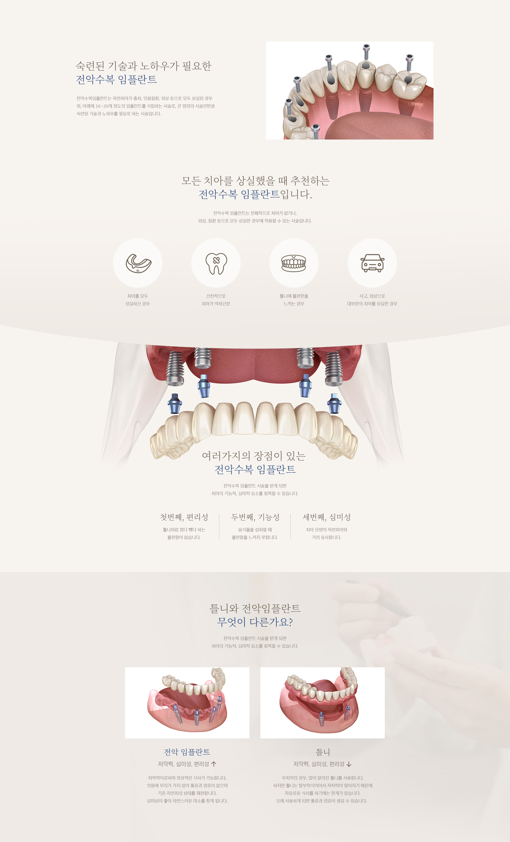 전악수복 임플란트