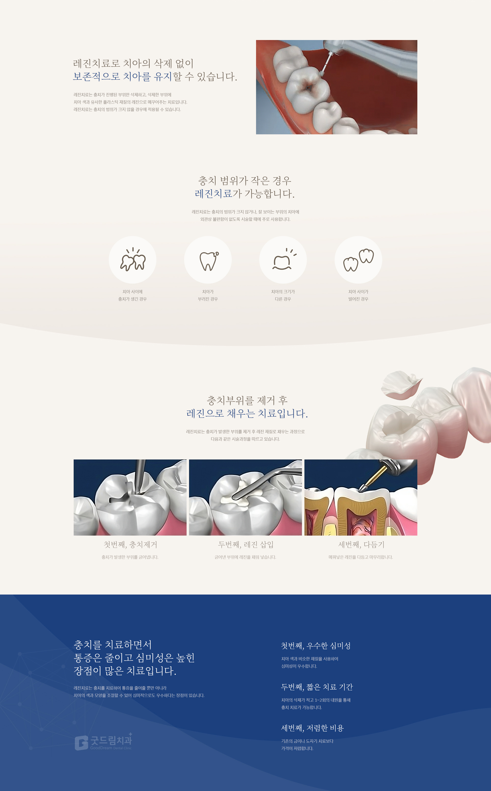 레진치료