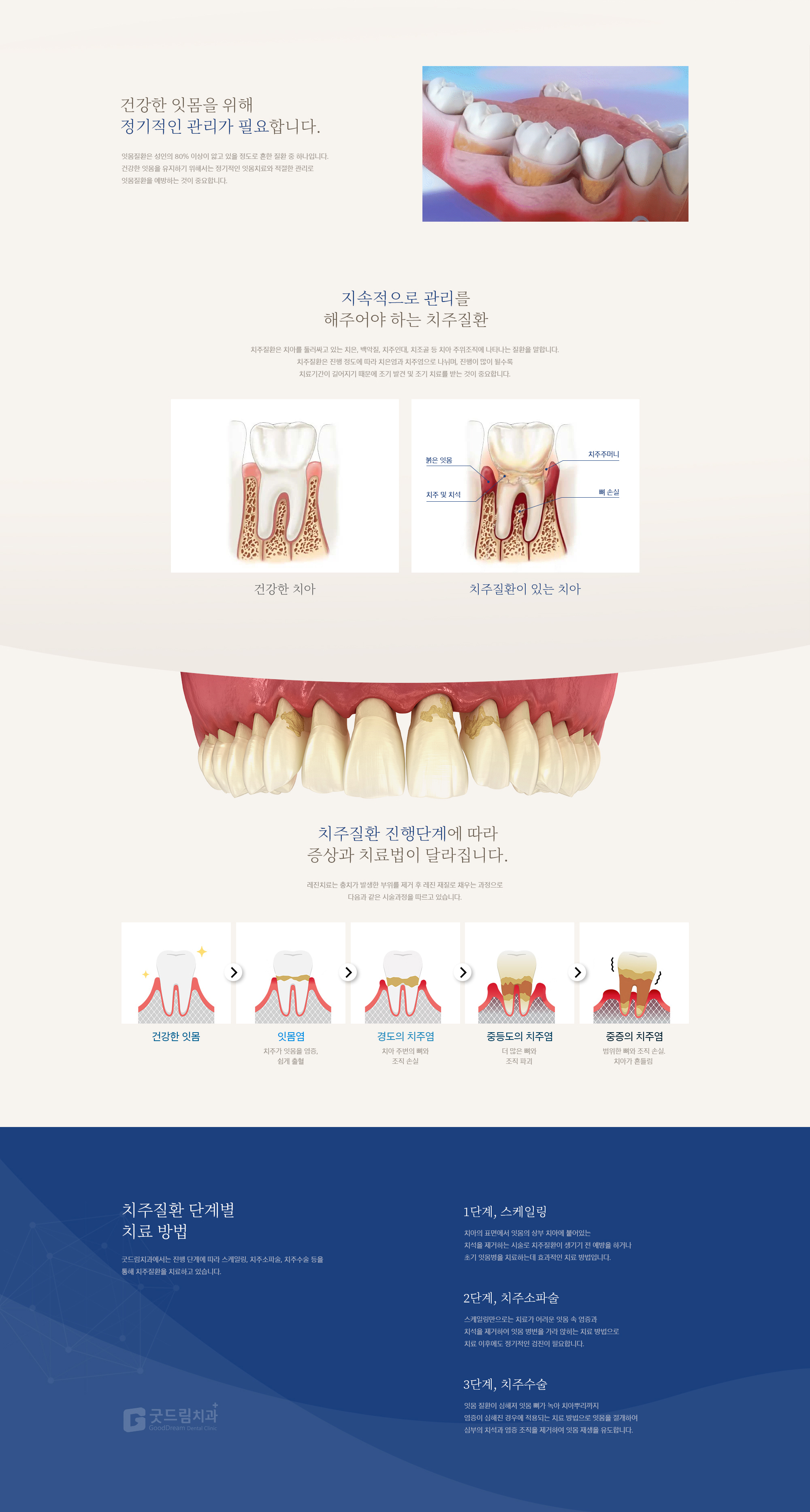 잇몸질환